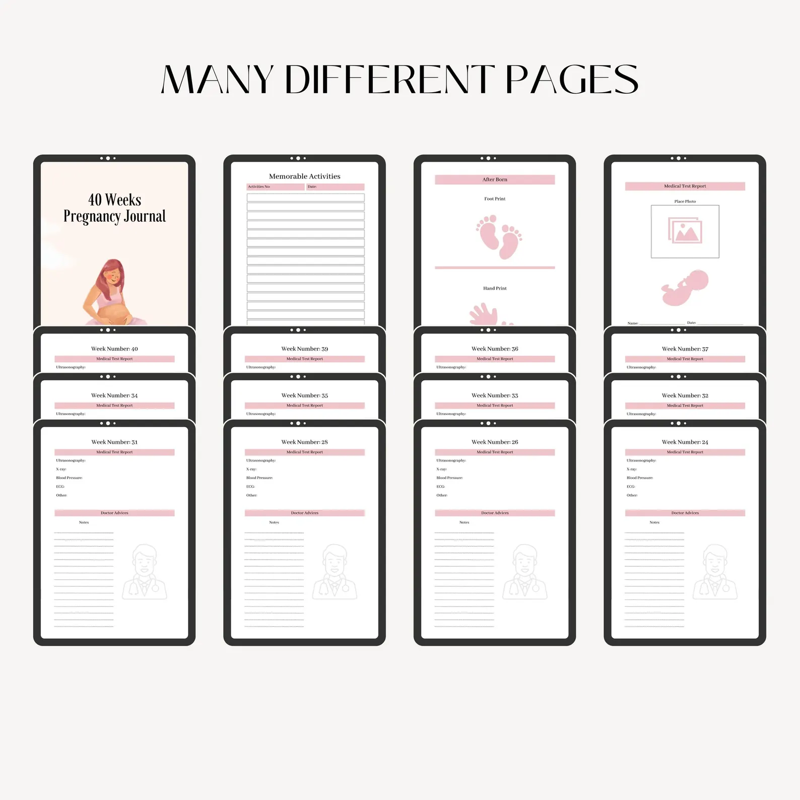 40 Weeks Pregnancy Journal: Editable Canva Template - Image 4